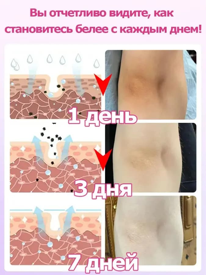 Отбеливающий крем для интимной зоны/Заметно отбеливает кожу