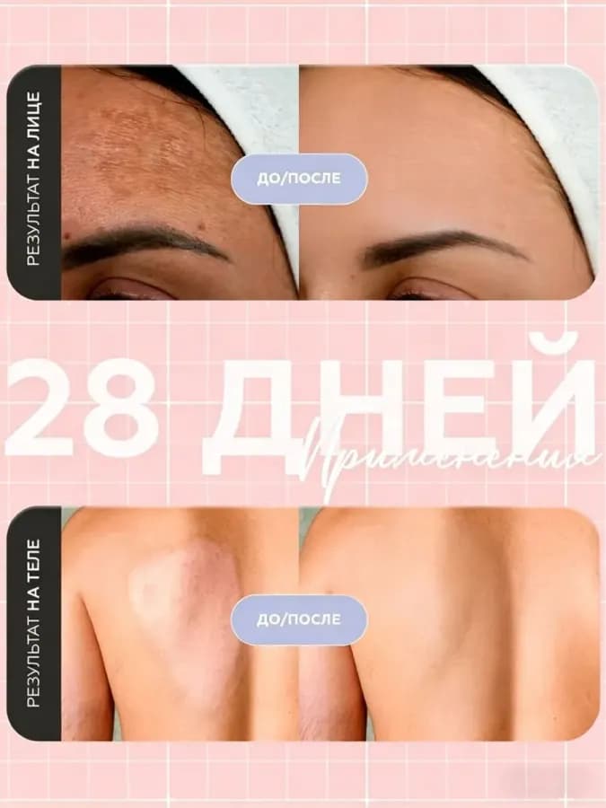 MR&MISS Отбеливающий крем для интимной зоны, тела, ягодиц — фото 2